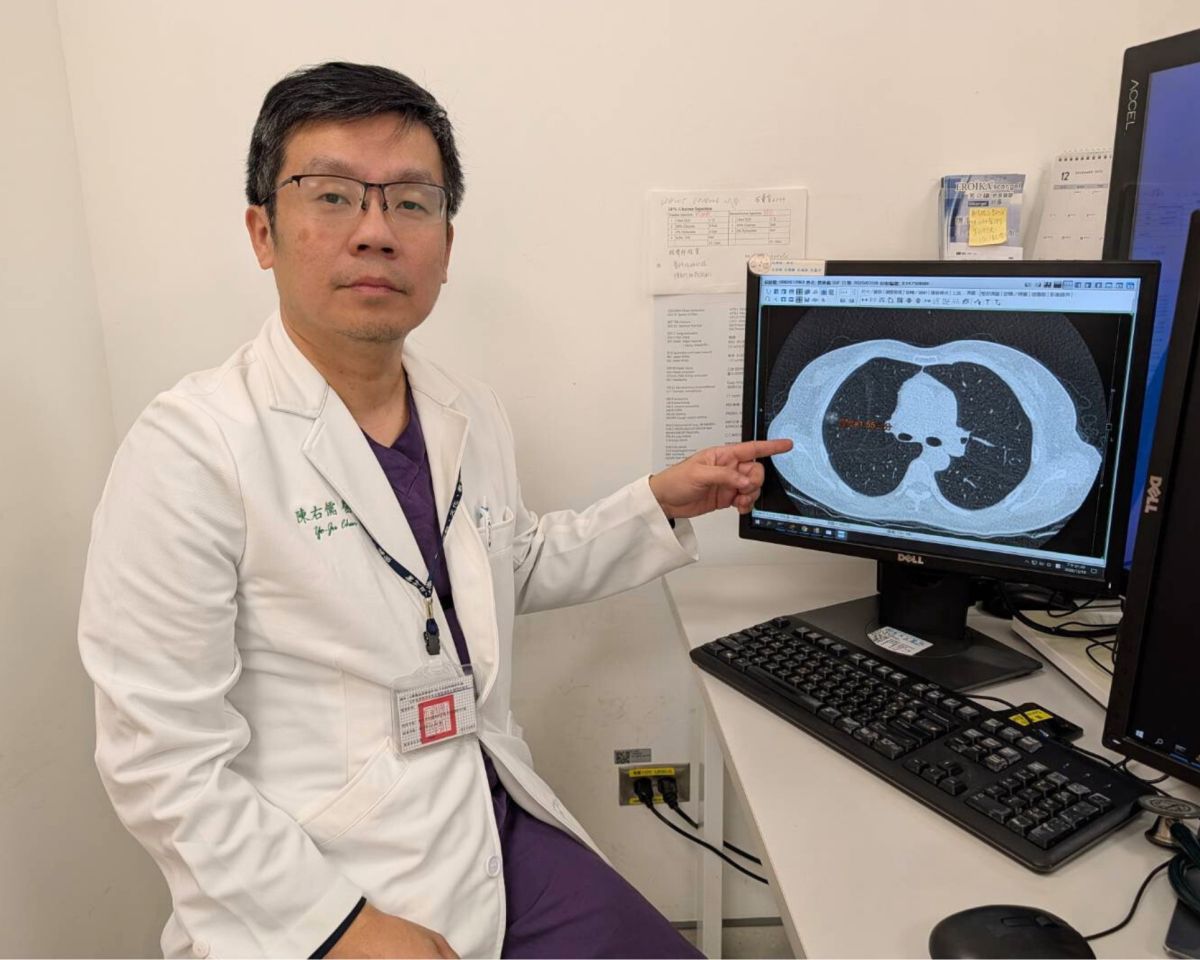 不抽菸也有風險　恩主公醫院示警肺癌家族史關鍵