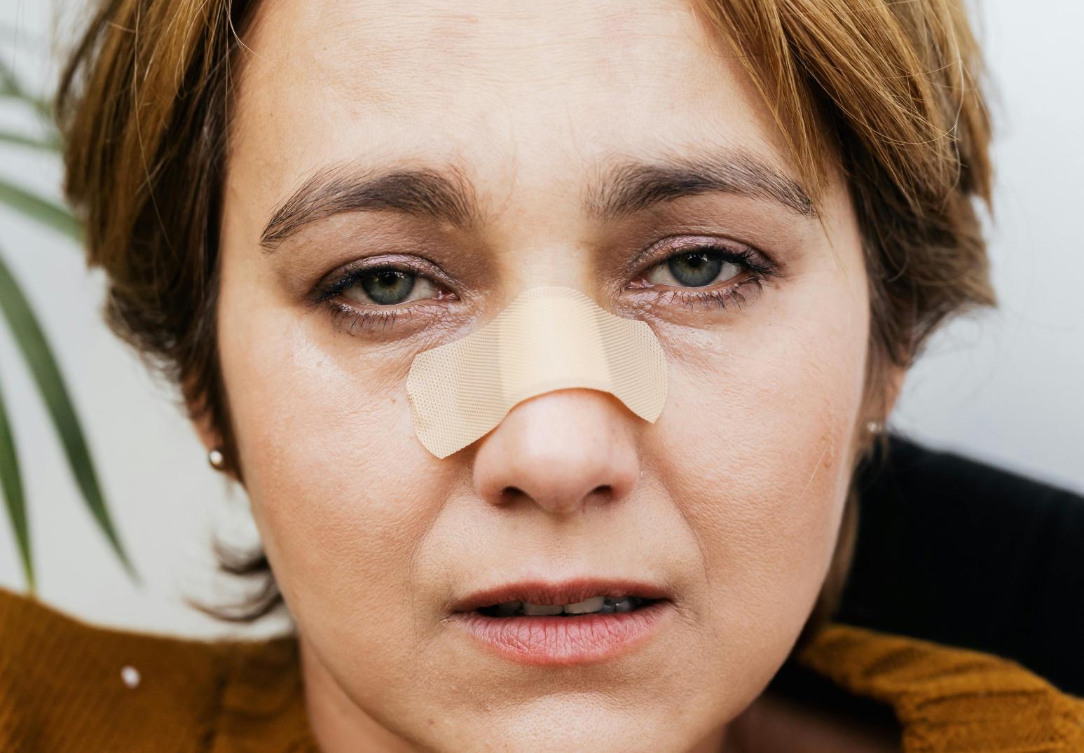 23歲幼師車禍鼻骨撞斷「剩小洞呼吸」取肋軟骨重建鼻樑