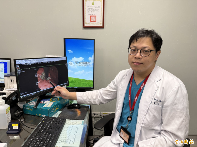 廚師賁門鬆弛胃食道逆流 抗逆流黏膜燒灼術助康復