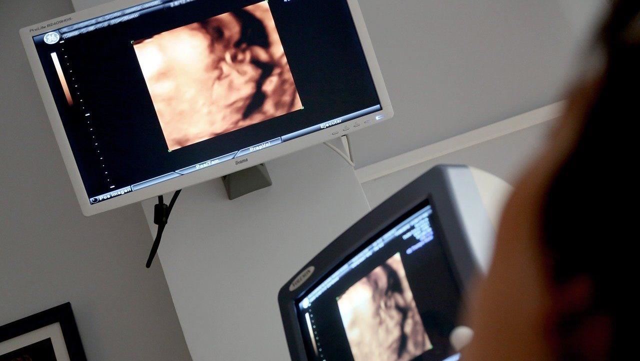 藍白力推代孕合法　石明謹揭「喬治亞取卵案」示警：台灣有準備好嗎