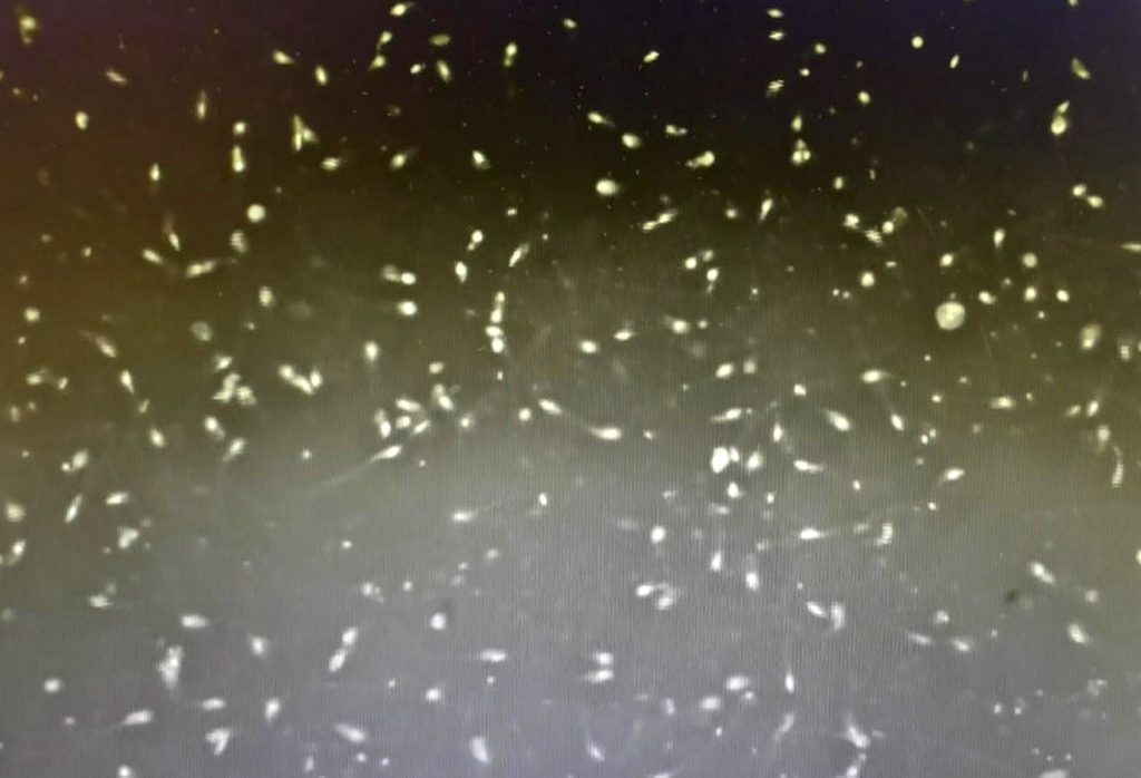 「甜」蜜陷阱 珍奶當飯吃 運將糖尿病不孕